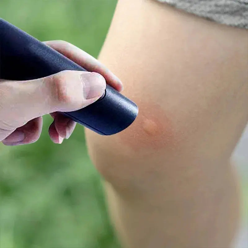 Pour démangeaison, piqûre, insecte, moustique, stylo portable, noir, soulage les enfants adultes, anti-démangeaison physique, bâton anti-démangeaison, anti-démangeaison, anti-démangeaison MedSurgery Store For Digital Health