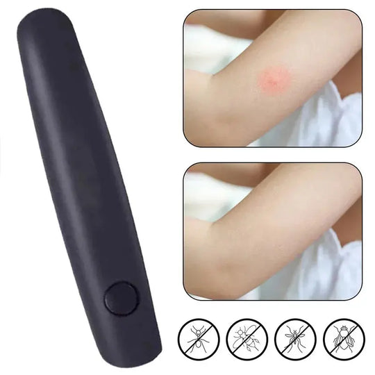 Pour démangeaison, piqûre, insecte, moustique, stylo portable, noir, soulage les enfants adultes, anti-démangeaison physique, bâton anti-démangeaison, anti-démangeaison, anti-démangeaison MedSurgery Store For Digital Health